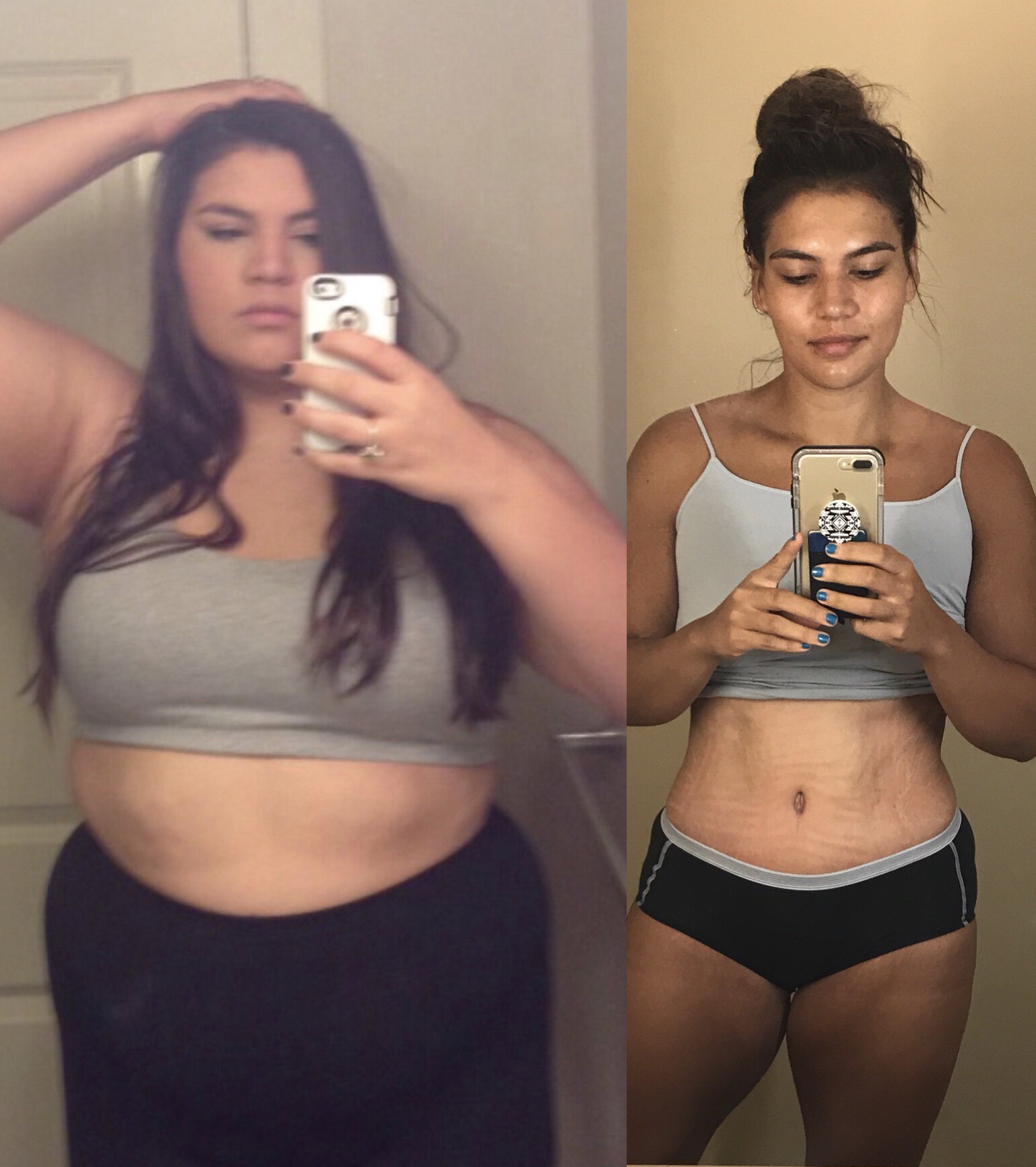До и после похудения подростки
