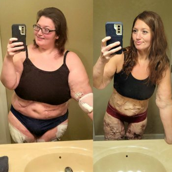 Fatgirlfedup's Fight to the Finish Dietb...